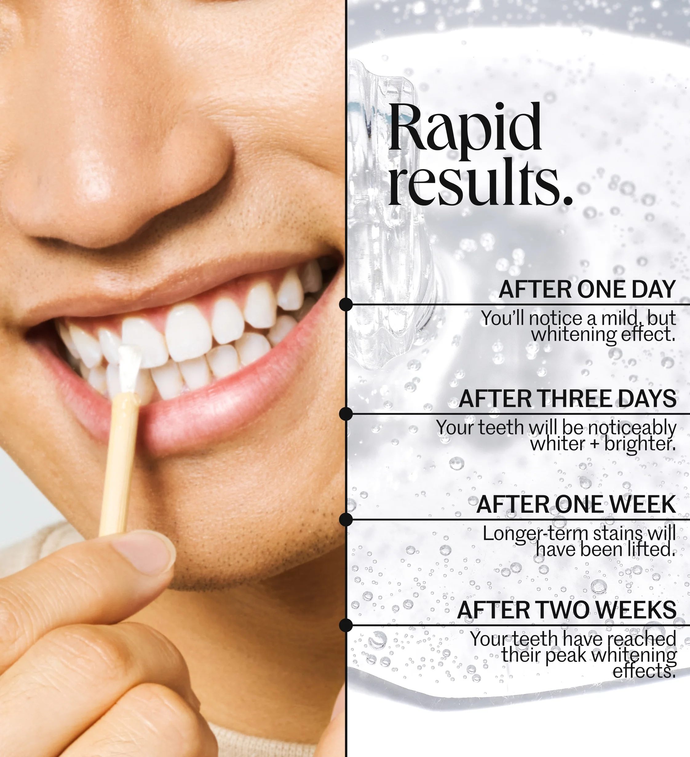 The Everyday Whitening System - Image 6